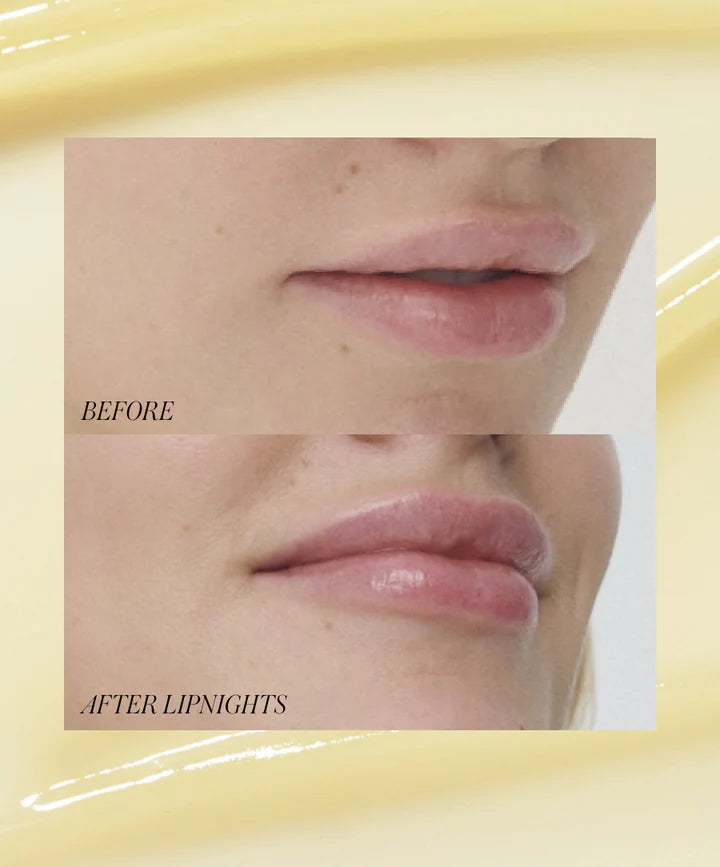 Lipnights Overnight Lip Mask